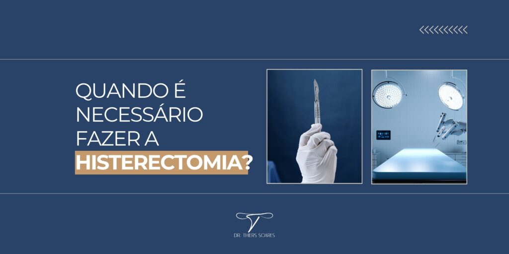 Imagine a seguinte situação: você tem mioma e tem o sonho de ser mãe, mas chega na consulta e ouve que tem que retirar o útero. Quem já passou por isso sabe o impacto emocional de ouvir essa sentença. Boa parte das pacientes que chegam até aqui acreditam que a cirurgia é a única resposta para o tratamento, mas existem outras alternativas. Então, antes de mais nada: você pode preservar o seu útero, mesmo com a presença de miomas.