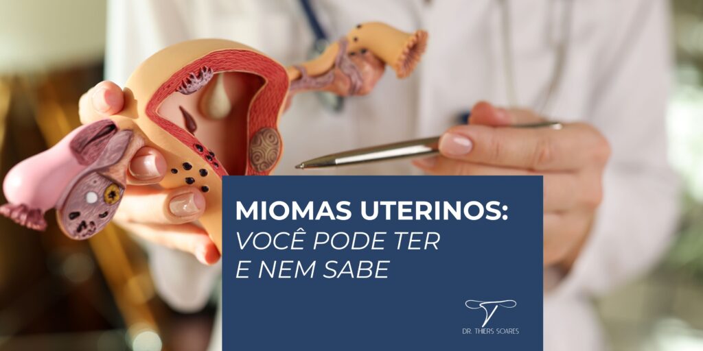 Os miomas são tumores que se formam no tecido muscular do útero da mulher, mas geralmente, eles são benignos. Eles podem ter tamanhos pequenos, a nível microscópico, ou serem maiores. Além disso, a região onde ele se encontra também é variável. Para fazer o diagnóstico, é necessário fazer algum tipo de exame de imagem, como ultrassonografia, ressonância magnética e histeroscopia.