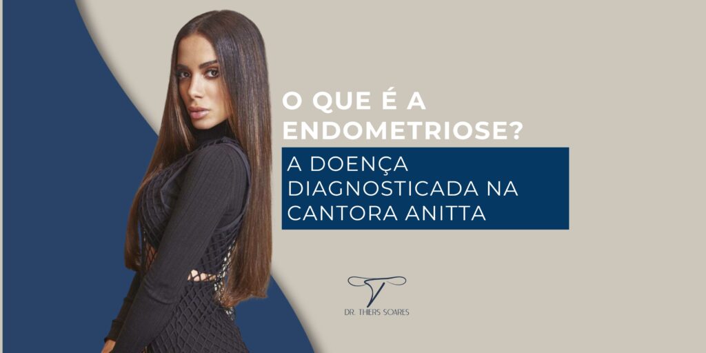 A Endometriose é uma doença inflamatória que acontece quando o Endométrio, a mucosa que reveste as paredes internas do útero, faz o caminho errado e, ao invés de sair durante a menstruação, ele vai para outros órgãos do corpo, como: ovário, intestino, trompas, bexiga e pulmão. Essa condição pode apresentar sintomas que atrapalham a vida da mulher, assim como aconteceu com a Anitta, que contou sobre as fortes dores que sentia após as relações sexuais. Além disso, outros sintomas característicos são: 