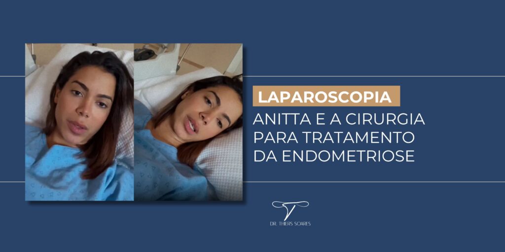 A Endometriose é uma doença inflamatória que acontece quando o Endométrio, a mucosa que reveste as paredes internas do útero, faz o caminho errado e, ao invés de sair durante a menstruação, ele vai para outros órgãos do corpo, como: ovário, intestino, trompas, bexiga e pulmão. Essa condição pode apresentar sintomas que atrapalham a vida da mulher, assim como aconteceu com a Anitta, que contou sobre as fortes dores que sentia após as relações sexuais. Além disso, outros sintomas característicos são: 
