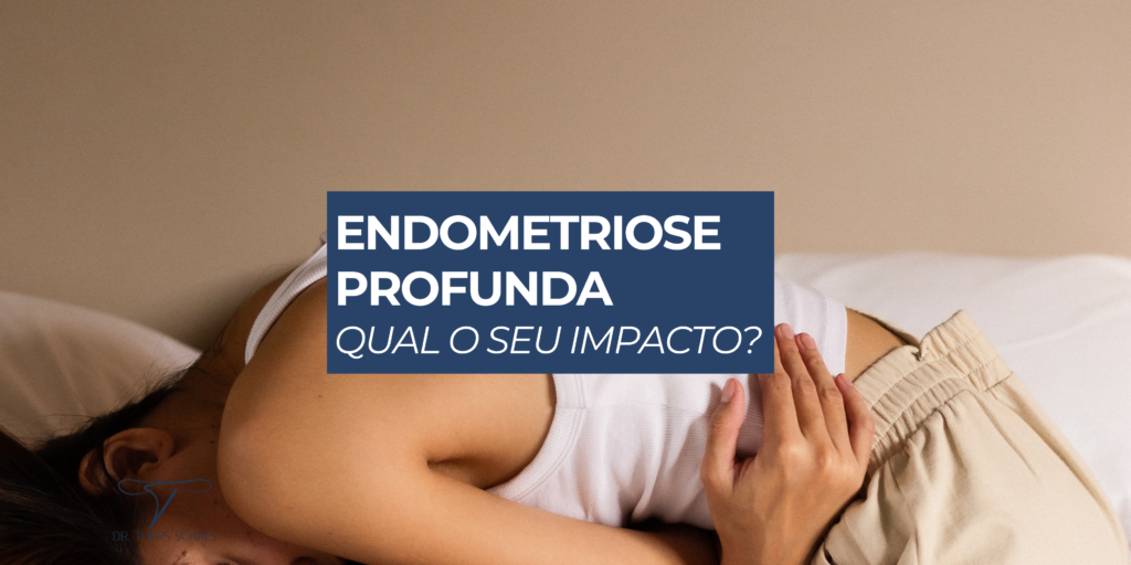 a forma mais severa é a Endometriose profunda, que traz os sintomas mais graves da doença e também afeta de forma intensa a qualidade de vida da mulher. Nesse tipo, a principal característica é a profundidade em que o tecido endometrial é encontrado, que é além de 5 milímetros abaixo da superfície peritoneal.