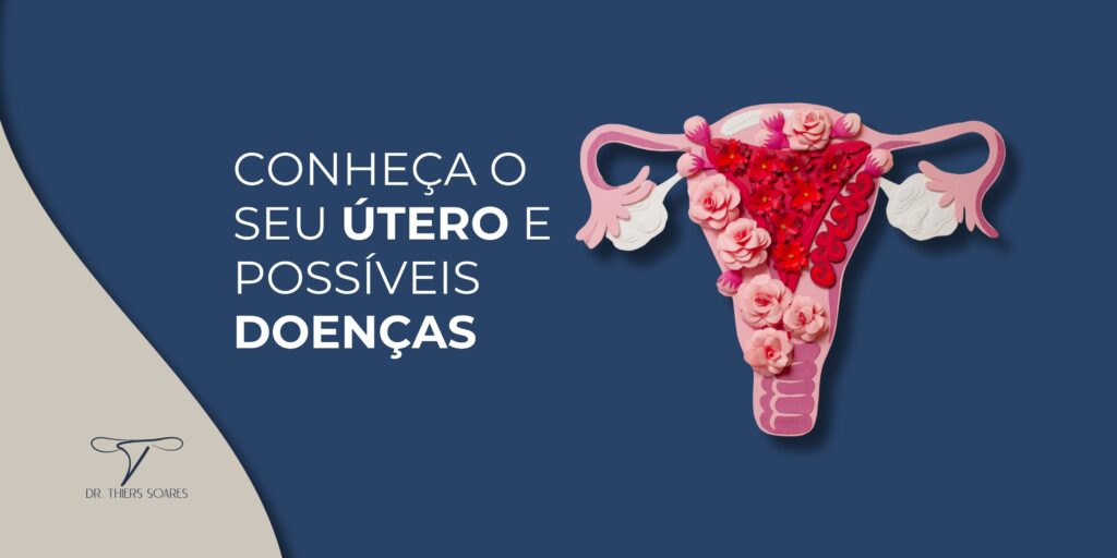 O útero é um órgão fundamental do sistema reprodutor feminino e responsável por abrigar o feto durante a gestação. Muitas mulheres não têm conhecimento ou informação a respeito da complexidade da sua saúde. Em se tratando do útero, bem como sua anatomia e funções, não seria diferente e, como consequência, a saúde reprodutiva pode ficar comprometida.