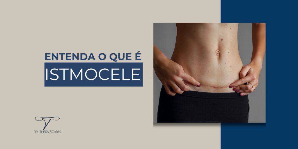 Essa doença pode ser caracterizada como: uma falha na cicatrização no local em que foi feita a incisão da cesariana para a retirada do bebê. Após a realização do parto é feita uma sutura, que com o tempo pode se transformar em uma cicatriz retrátil e resultar em uma falha da musculatura uterina, conhecida como miométrio. A Istmocele é dividida em dois tipos, que variam de acordo com o seu tamanho.