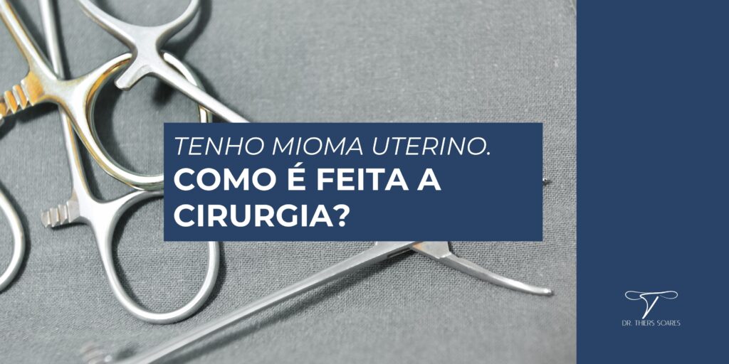 Os miomas são tumores benignos que afetam as mulheres na fase reprodutiva e podem ser encontrados em diversas regiões do útero, com tamanhos e em quantidades diferentes. Como mencionado, é comum que não haja manifestação de sintomas e, por este motivo, nem sempre é necessário realizar uma cirurgia. Em muitos casos, os miomas podem ser tratados de uma maneira menos invasiva. 
