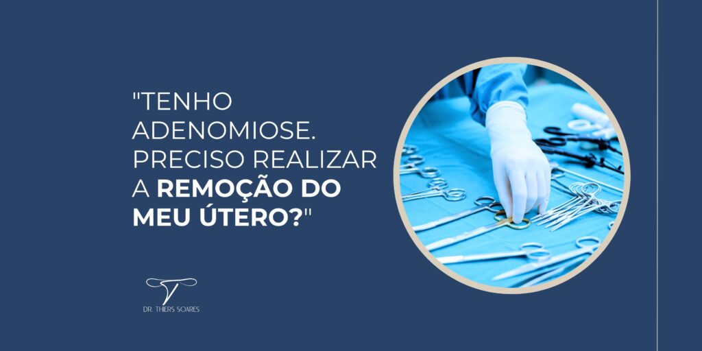 Cada caso é único, e um médico especialista poderá orientar a paciente sobre as opções disponíveis para realizar o sonho de ter filhos, mesmo após a melhora da adenomiose. Ao decidir entre a remoção do útero ou explorar outras opções cirúrgicas para tratar essa doença, a paciente deve estar em constante diálogo com um médico especialista, que buscará a melhor solução.