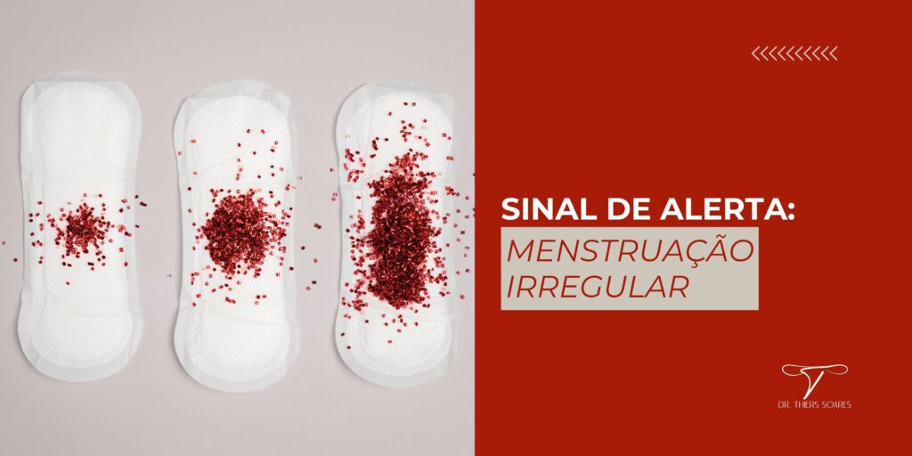 A menstruação irregular é um fenômeno comum que pode afetar mulheres em diferentes estágios da vida e pode causar desconforto e preocupação. Ela se manifesta de diferentes formas, como alterações na duração do ciclo, quantidade de fluxo menstrual, intervalos irregulares entre os períodos ou até mesmo a ausência da menstruação por longos períodos.