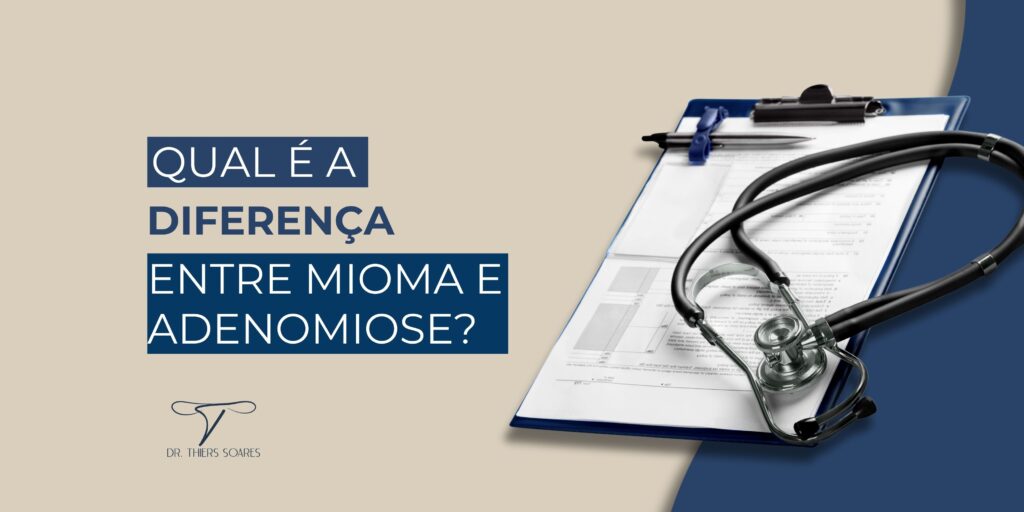 O tratamento ideal para miomas uterinos e adenomiose pode variar de acordo com a gravidade dos sintomas, a idade da paciente, seus planos reprodutivos e outros fatores individuais. É importante ressaltar que apenas um profissional especializado pode determinar o melhor planejamento para cada caso específico, portanto, é essencial fazer pesquisas e buscar segundas opiniões.