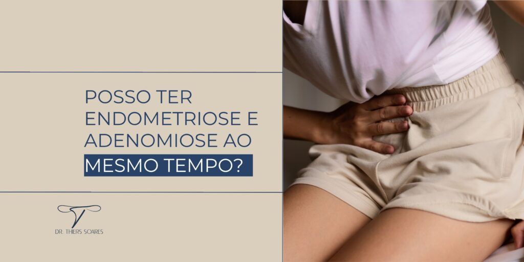 A endometriose e a adenomiose são duas condições ginecológicas que afetam milhões de mulheres ao redor de todo o mundo, elas causam um desconforto significativo e impactam profundamente a qualidade de vida. A endometriose ocorre quando o tecido semelhante ao revestimento uterino, conhecido como endométrio, cresce fora do útero, muitas vezes nas regiões pélvicas e abdominais.