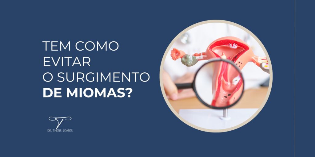 O mioma uterino, também conhecido como leiomioma ou fibroma, é um tumor benigno que se desenvolve no útero das mulheres. É causado pelo crescimento de uma célula única muscular e pode variar em tamanho, desde um pequeno nódulo até crescimentos maiores que ocupam uma parte significativa do útero. A sua formação é um fenômeno complexo e ainda não existe comprovação para o surgimento deles, mas existem várias teorias e fatores de risco que têm sido identificados.