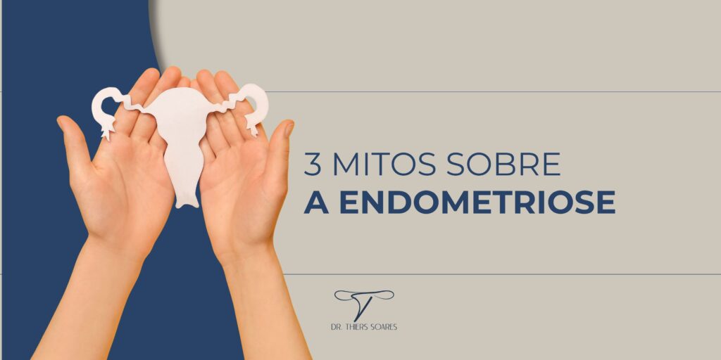 A endometriose é uma doença ginecológica que, segundo o Ministério da Saúde, afeta uma a cada dez mulheres no Brasil. No entanto, um dos maiores desafios enfrentados por muitas pacientes é a falta de conhecimento profundo sobre a doença. Além disso, também observa-se uma falta de informações sobre a endometriose por muitos profissionais de saúde, o que pode levar a diagnósticos tardios ou incorretos.  Essa lacuna de informação é a raiz de muitos mitos sobre a endometriose, pois quando as pessoas não têm acesso a dados precisos e atualizados, é natural que surjam ideias erradas e concepções equivocadas sobre a condição. Portanto, é muito importante que haja um esforço para educar tanto o público em geral quanto os profissionais de saúde sobre a endometriose, para promover um diagnóstico precoce e tratamento adequado.
