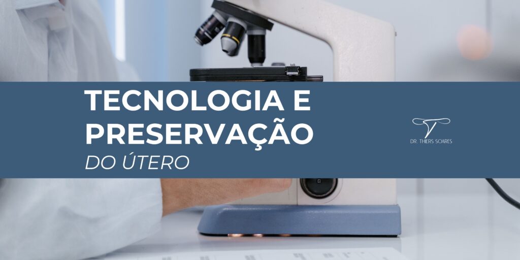 A evolução da tecnologia médica transformou o tratamento dos **miomas uterinos**, trazendo avanços importantes na **preservação do útero**. Entre essas inovações, destaca-se a **Miomectomia Robótica**, técnica minimamente invasiva que permite remover miomas com alta precisão, menor perda de sangue e recuperação mais rápida. Durante o Congresso Mundial da FIGO, o **Dr. Thiers Soares** apresentou uma palestra sobre o tema, reforçando que essa tecnologia veio para ficar e é atualmente a melhor opção para preservar o útero e a fertilidade feminina. Diferente da miomectomia convencional, que exige incisões maiores e tem recuperação mais longa, a **Miomectomia Robótica** oferece benefícios como menor dor, cicatrizes reduzidas e resultados cirúrgicos mais seguros. Essa técnica representa um avanço significativo para mulheres que desejam tratar miomas sem comprometer a possibilidade de engravidar. Com orientação médica adequada e acompanhamento especializado, é possível enfrentar os **miomas uterinos** com menos riscos e mais qualidade de vida.