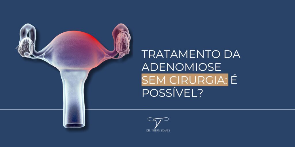 A descoberta de um diagnóstico de adenomiose já é responsável por gerar uma série de emoções, e a possibilidade de um procedimento cirúrgico pode intensificar a ansiedade e a insegurança em muitas mulheres. A incerteza em torno da intervenção cirúrgica pode criar um ambiente de apreensão, principalmente quando se considera os desafios físicos e emocionais associados ao tratamento da adenomiose. Muitas mulheres, ao se depararem com essa possibilidade, enfrentam dilemas e preocupações sobre o impacto da cirurgia em suas vidas, desde a recuperação física até as implicações emocionais associadas à decisão de passar por um procedimento invasivo. Mas será que existe a necessidade de realizar um procedimento cirúrgico nesses casos? Essa é uma pergunta de diversas mulheres e que será respondida nesse texto! Quais os tratamentos para a adenomiose A abordagem terapêutica para a adenomiose pode variar, e nem todas as mulheres diagnosticadas precisam passar por uma cirurgia. Métodos menos invasivos, como terapias medicamentosas e procedimentos minimamente invasivos, também podem ser considerados, mas isso vai variar da gravidade dos sintomas e das necessidades individuais da paciente. A decisão deve ser tomada em colaboração entre a paciente e sua equipe médica, levando em conta o equilíbrio entre os benefícios do tratamento e os potenciais impactos na qualidade de vida. Existem algumas abordagens não-cirúrgicas que podem ser consideradas: Medicamentos para Alívio Sintomático: Se os sintomas da adenomiose forem leves a moderados, a abordagem inicial pode envolver medicamentos, como anti-inflamatórios não esteroides (AINEs), prescritos pelo médico. Embora esses medicamentos ajudem a aliviar a dor e reduzir o sangramento, é importante observar que eles não tratam a condição em sua totalidade. Terapia Hormonal para Controle dos Sintomas: Terapias hormonais oferecem alternativas eficazes para controlar os sintomas da adenomiose. Dispositivos intrauterinos liberadores de levonorgestrel (DIU-LNG), medicamentos hormonais combinados (estrogênio + progesterona) ou progesterona isolada são opções que ajudam a controlar o crescimento excessivo do tecido endometrial, contribuindo para o alívio dos sintomas. Abordagens Complementares para Melhorar a Qualidade de Vida: Além dos tratamentos médicos convencionais, outras opções, como fisioterapia, acupuntura e uma dieta anti-inflamatória, podem ser exploradas para melhorar a qualidade de vida das pacientes com adenomiose. Essas abordagens complementares podem ser associadas para oferecer um tratamento mais completo para essa condição. Quando é necessário fazer tratamentos cirúrgicos Ao optar por uma cirurgia para tratar a adenomiose, os procedimentos minimamente invasivos são as opções mais inovadoras e eficazes. A retirada cirúrgica da adenomiose, especialmente através da via robótica, se destaca como uma abordagem cirúrgica avançada, pois proporciona benefícios como menor tempo de recuperação e menor impacto nos tecidos circundantes. Já a ablação por radiofrequência é uma técnica inovadora, que oferece uma alternativa de tratamento ao destruir termicamente a adenomiose. É essencial destacar, no entanto, que esses procedimentos cirúrgicos reduzem parcialmente a adenomiose, já que traz alívio dos sintomas e melhora a qualidade de vida, mas a cura definitiva só é alcançada com a retirada do útero, conhecida como histerectomia. A escolha entre as opções cirúrgicas deve ser cuidadosamente discutida e considerada em colaboração com o médico, que deve levar em consideração as necessidades específicas de cada paciente. A decisão deve refletir não apenas a eficácia clínica, mas também os objetivos reprodutivos, as preferências individuais e o impacto potencial na qualidade de vida da mulher afetada pela adenomiose. Busque o melhor tratamento para o seu caso É crucial enfatizar que o tratamento da adenomiose requer uma abordagem altamente personalizada, que deve considerar uma série de fatores específicos em cada caso, como: gravidade dos sintomas; idade da paciente; objetivos de saúde; desejo de engravidar; preferências pessoais. Cada mulher enfrenta a adenomiose de maneira única, por isso é importante que os profissionais de saúde adotem uma abordagem adaptativa, que leve em consideração as complexidades individuais de cada paciente. A personalização do tratamento permite uma resposta mais eficaz aos desafios específicos apresentados por cada caso de adenomiose. Seja por meio de terapias hormonais, medicamentos para alívio sintomático, procedimentos minimamente invasivos ou considerando a opção mais definitiva da histerectomia, a decisão deve ser cuidadosamente moldada para atender às necessidades únicas da paciente. Portanto, é essencial uma comunicação aberta e colaborativa entre a equipe médica e a paciente, para garantir que as escolhas terapêuticas se alinhem não apenas com a condição médica em questão, mas também com as expectativas e valores individuais da mulher afetada pela adenomiose. Marque a sua consulta! Consultório Doutor Thiers Soares Endereço: Rua Visconde de Pirajá, 595/Sala 305 Telefone e WhatsApp: (21) 99516-5635 Instagram: @thiers