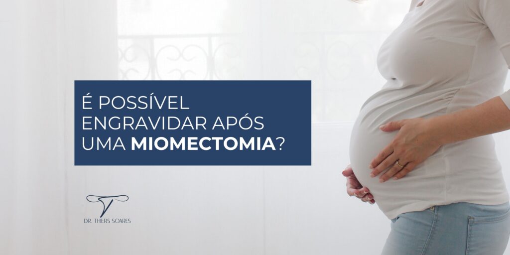 Descubra quando não é necessário retirar miomas, como preservar o útero e manter a fertilidade. Saiba mais com o Dr. Thiers Soares