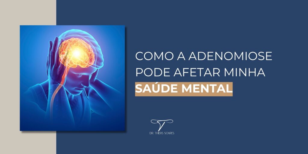 A Adenomiose é uma condição ginecológica complexa que pode ter um impacto significativo na saúde mental das mulheres que a enfrentam. Esta condição, muitas vezes dolorosa e debilitante, não se limita apenas aos sintomas físicos, mas também pode desencadear uma série de desafios emocionais e psicológicos. Compreender a relação entre a adenomiose e a saúde mental é fundamental para oferecer um suporte abrangente para as pacientes. De acordo com a Organização Mundial da Saúde, uma em cada 10 mulheres no planeta pode ter adenomiose. Aproximadamente um terço não manifesta sinais. Quando eles surgem, os principais são dores menstruais e aumento do fluxo menstrual. A dificuldade para engravidar também é um indício importante da presença da condição.