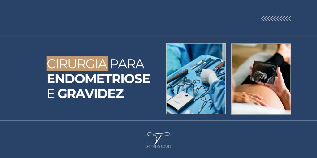 Uma paciente que apresentava comprometimento extenso da pelve, acometimento dos ovários, intestino e paramétrio (parte lateral ao útero, por onde passam ureter, nervos e vasos), está grávida após a realização de cirurgia como tratamento.  Sua pelve foi tratada e os seus ovários foram preservados. A paciente engravidou de maneira natural e enviou essa mensagem de alegria e realização com o seu filho. Este caso mostra que a cirurgia pode sim ser efetiva para quem quer engravidar. Veja mais sobre o assunto: