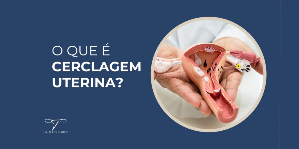 A cerclagem uterina é um procedimento cirúrgico realizado para prevenir o parto prematuro, especialmente em mulheres com histórico de insuficiência cervical. Esta condição é caracterizada pela incapacidade do colo do útero de permanecer fechado, elevando o risco de parto antes das 37 semanas. O procedimento envolve o reforço do colo do útero por um médico especializado, que coloca suturas ou um anel ao redor dele para mantê-lo fechado até o momento do parto.