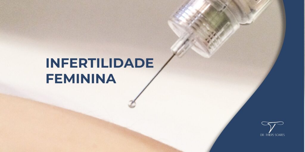 A infertilidade é uma condição que afeta entre 15% e 20% dos casais em idade fértil. Consideramos um casal infértil quando, após um ano de relações sexuais regulares sem contracepção, não ocorre a gravidez. Esse intervalo se reduz para seis meses se a mulher tiver mais de 35 anos, devido à influência significativa da idade na fertilidade feminina. Após os 35 anos, a taxa de ovulação diminui, o que impacta diretamente as chances de engravidar. Contudo, a idade não é o único fator que pode levar à infertilidade.