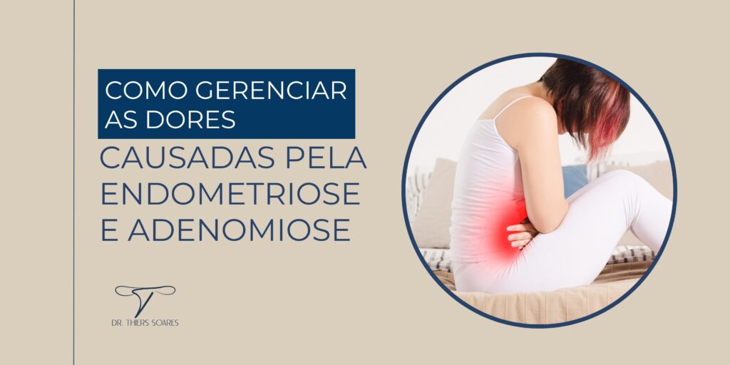 Entre as condições que podem afetar a saúde feminina e o sistema reprodutivo, a endometriose e a adenomiose são bastante comuns e podem causar dores intensas. Ambas atingem mulheres em idade fértil e têm características semelhantes, mas são condições distintas. A endometriose ocorre quando células semelhantes às do revestimento interno do útero crescem fora dele, podendo atingir órgãos como ovários, bexiga e intestinos. Já a adenomiose, acontece quando essas células penetram na camada muscular do útero, chamada miométrio. Apesar das semelhanças, essas condições podem até ocorrer simultaneamente, e ambas podem dificultar a fertilidade se não forem tratadas de forma adequada.