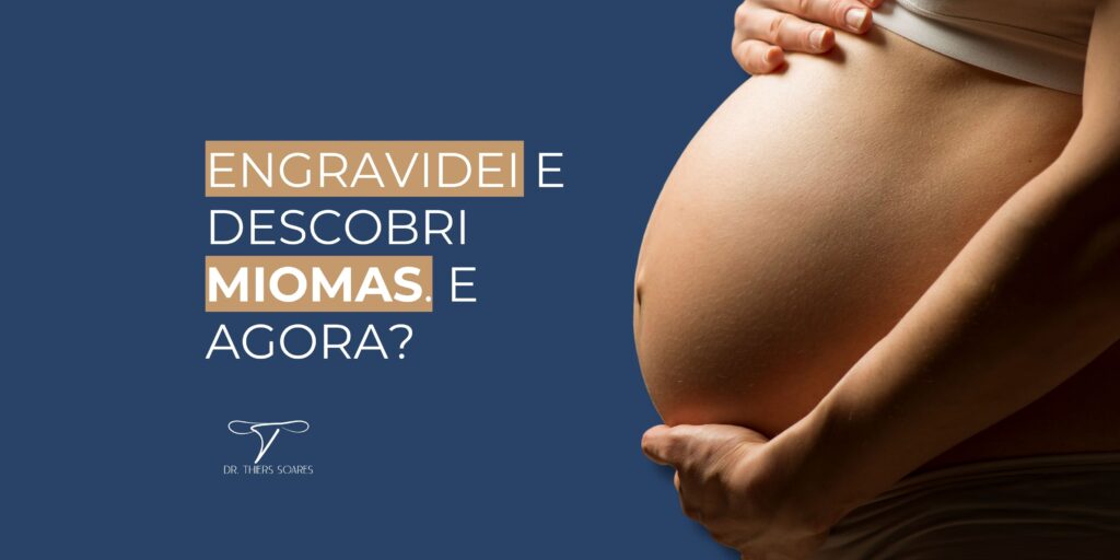 Para muitas mulheres, receber um diagnóstico de mioma uterino pode trazer preocupações imediatas sobre a fertilidade. Para as gestantes, a ideia de ter alguma alteração no útero se torna ainda mais preocupante. Entretanto, esse problema nem sempre interfere na gravidez ou causa sintomas. Muitas mulheres descobrem os miomas durante exames de rotina com o ginecologista. Então, antes de se preocupar, é essencial compreender mais sobre o assunto.