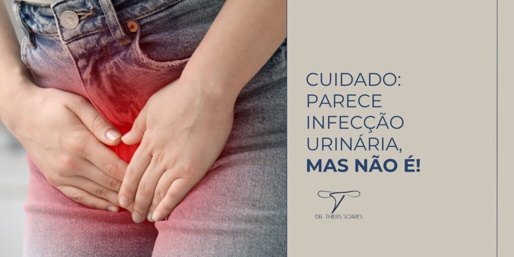 Infecção urinária é uma condição provocada por bactérias ou fungos que infectam o trato urinário e começam a se proliferar. Esse problema afeta mais as mulheres devido à sua anatomia: a uretra delas é mais curta e a proximidade entre a vagina e o ânus facilita a entrada de microrganismos. Também chamada de infecção do trato urinário (ITU), essa condição é bastante comum e, em alguns casos, pode não apresentar sintomas evidentes. Sintomas de infecção urinária: Urgência frequente para urinar; Quantidade reduzida de urina em cada vez que vai ao banheiro; Sensação de queimação ao urinar; Dores na bexiga, nas costas e na região abdominal inferior; Febre; Presença de sangue na urina em casos mais severos.