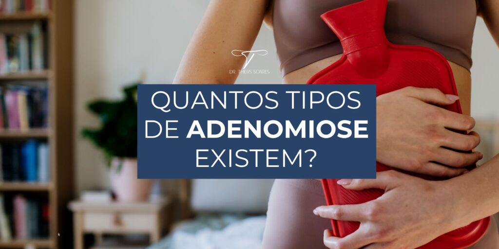 A endometriose é uma condição em que células do revestimento uterino se desenvolvem fora da área onde deveriam estar, causando inflamação em outras partes do corpo. Esse revestimento, conhecido como endométrio, está diretamente ligado ao ciclo menstrual. Quando não há fecundação, ele é parcialmente expelido durante a menstruação. Mas será que a menopausa pode de fato resolver o problema da endometriose?