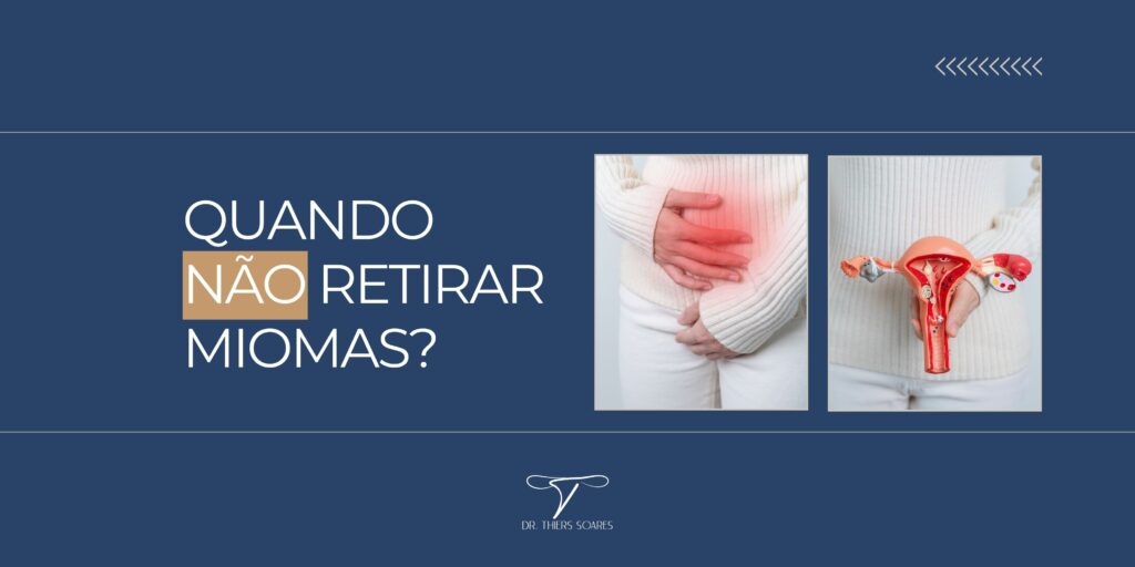 Muitas mulheres podem conviver com miomas sem que eles causem impacto significativo, optando por uma abordagem de monitoramento em vez de intervenções cirúrgicas. Abaixo, veja alguns cenários em que não é necessário remover um mioma e as razões para isso: