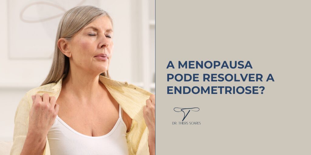 A endometriose é uma condição em que células do revestimento uterino se desenvolvem fora da área onde deveriam estar, causando inflamação em outras partes do corpo. Esse revestimento, conhecido como endométrio, está diretamente ligado ao ciclo menstrual. Quando não há fecundação, ele é parcialmente expelido durante a menstruação. Mas será que a menopausa pode de fato resolver o problema da endometriose?