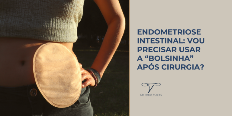 Quando é necessária a ostomia, popularmente chamada como “bolsinha” de colostomia?