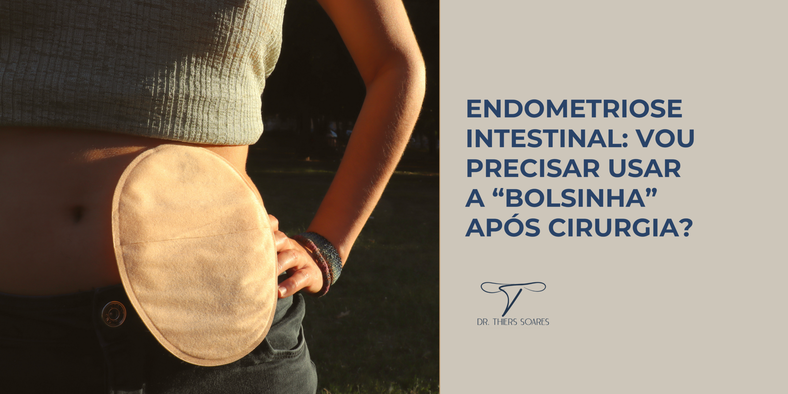 Quando é necessária a ostomia, popularmente chamada como “bolsinha” de colostomia?